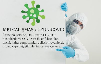 covid-19un-beyin-ustundeki-etkisi